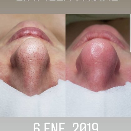 Limpieza Punta Diamante